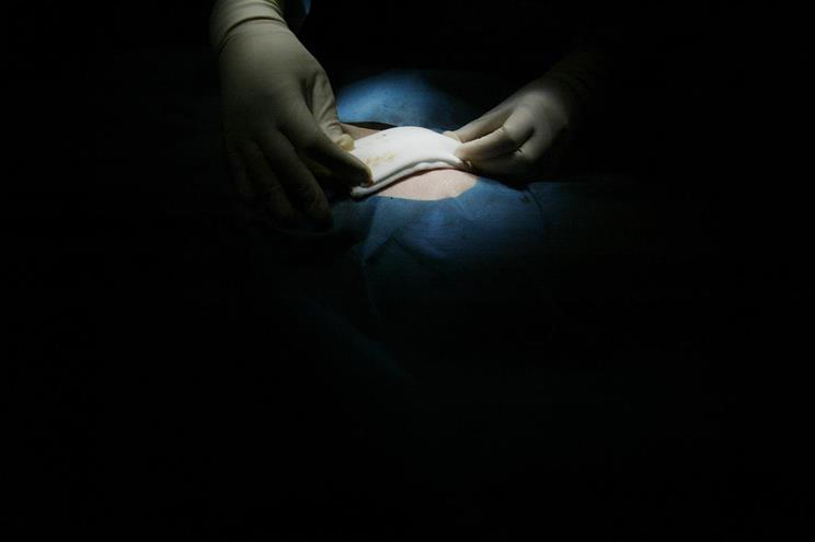 Português recebeu dispositivo inovador para tratar insuficiência cardíaca