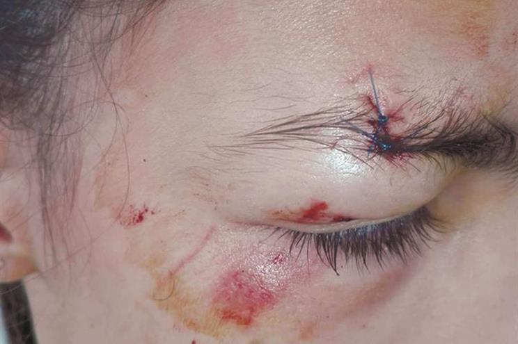 Agredida no recreio por usar mochila com rodinhas